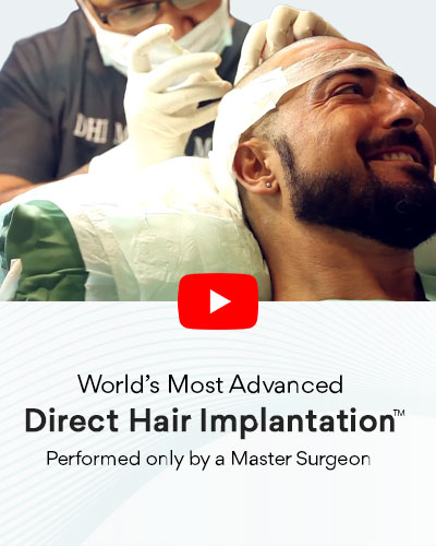 hair transplant in india